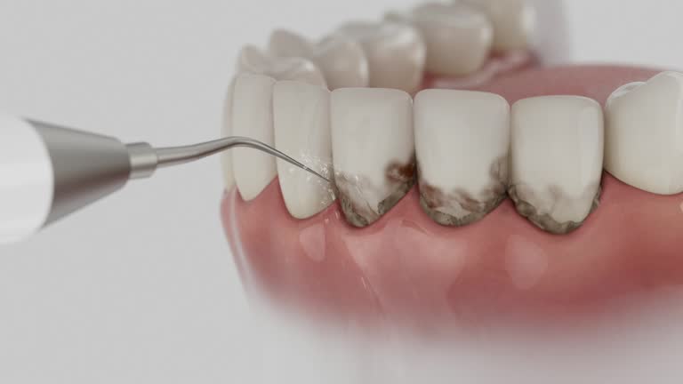 Reliable Tooth Extraction contractor in Lucerne Valley, CA by Smile Center Dentistry